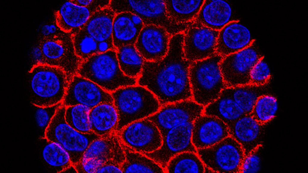Experimental pill promises new hope for deadly pancreatic cancer